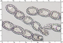 Genea hispidula
